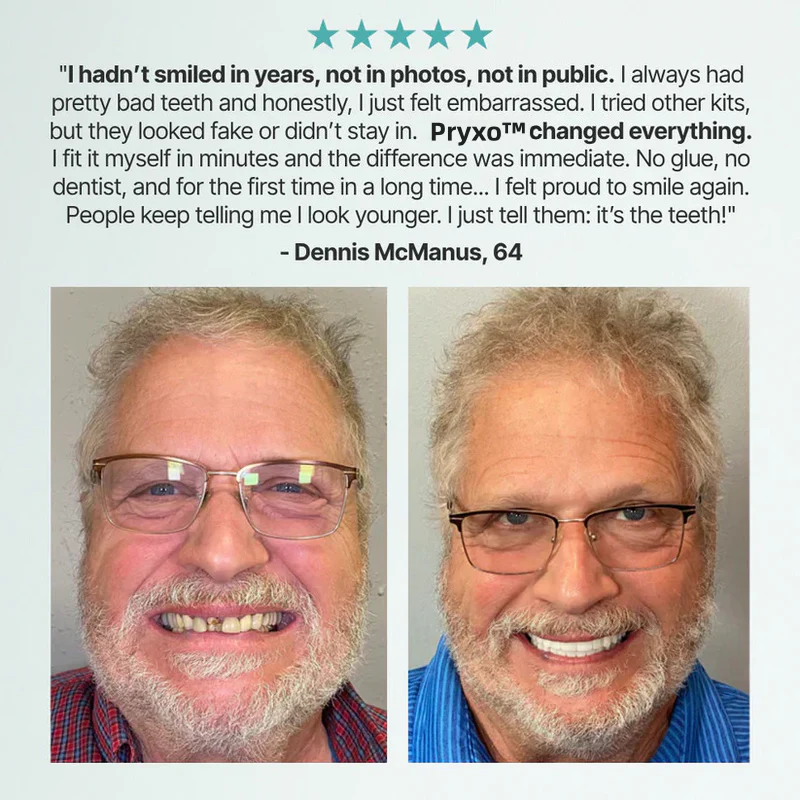 Ends Today: 70% OFF! Pryxo™? Custom-Fit Full Functional DenturesMake you more confident - Image 13